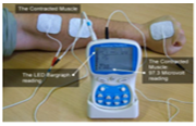 cerebral-palsy-treatment-in-calicut